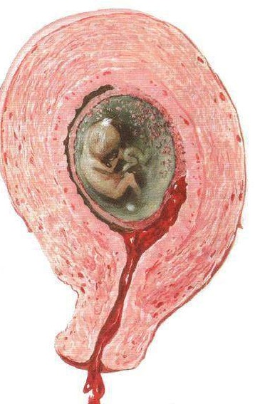 真妮早早孕试纸