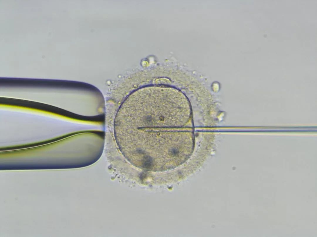 男性生育功能缺失