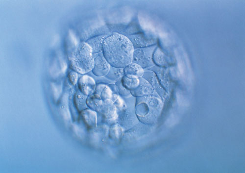 胚胎移植